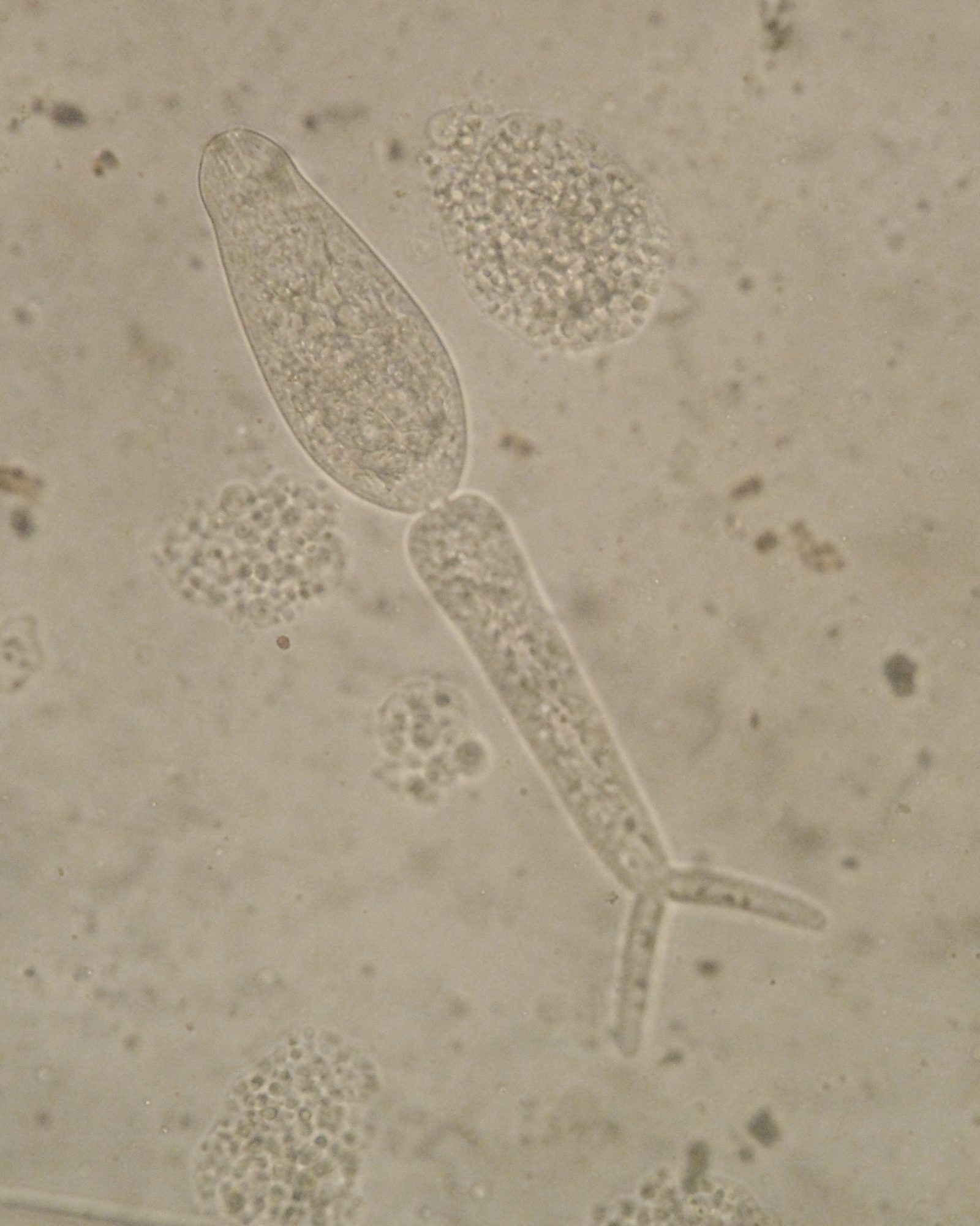 An infectious schistosome cercariae - the parasite life stage that seeks out and penetrates the skin of unsuspecting human bathers.