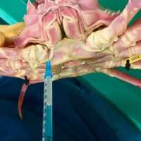 A needle is inserted into the underside of a pink-colored crab.